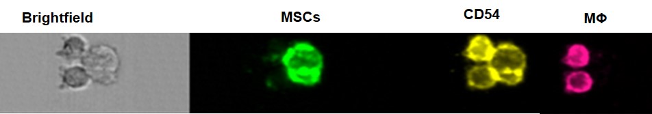 Interaction entre les cellules stromales mesenchymateuses (vert) et les macrophages (violet) via le CD54 (jaune) in vitro (image de gauche) et in vivo (image de droite). Crédit: A.Varin-C.Barreau